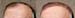 retouching more hair